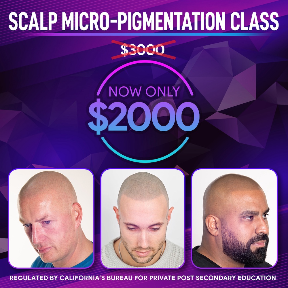 SMP Scalp Micro-Pigmentation